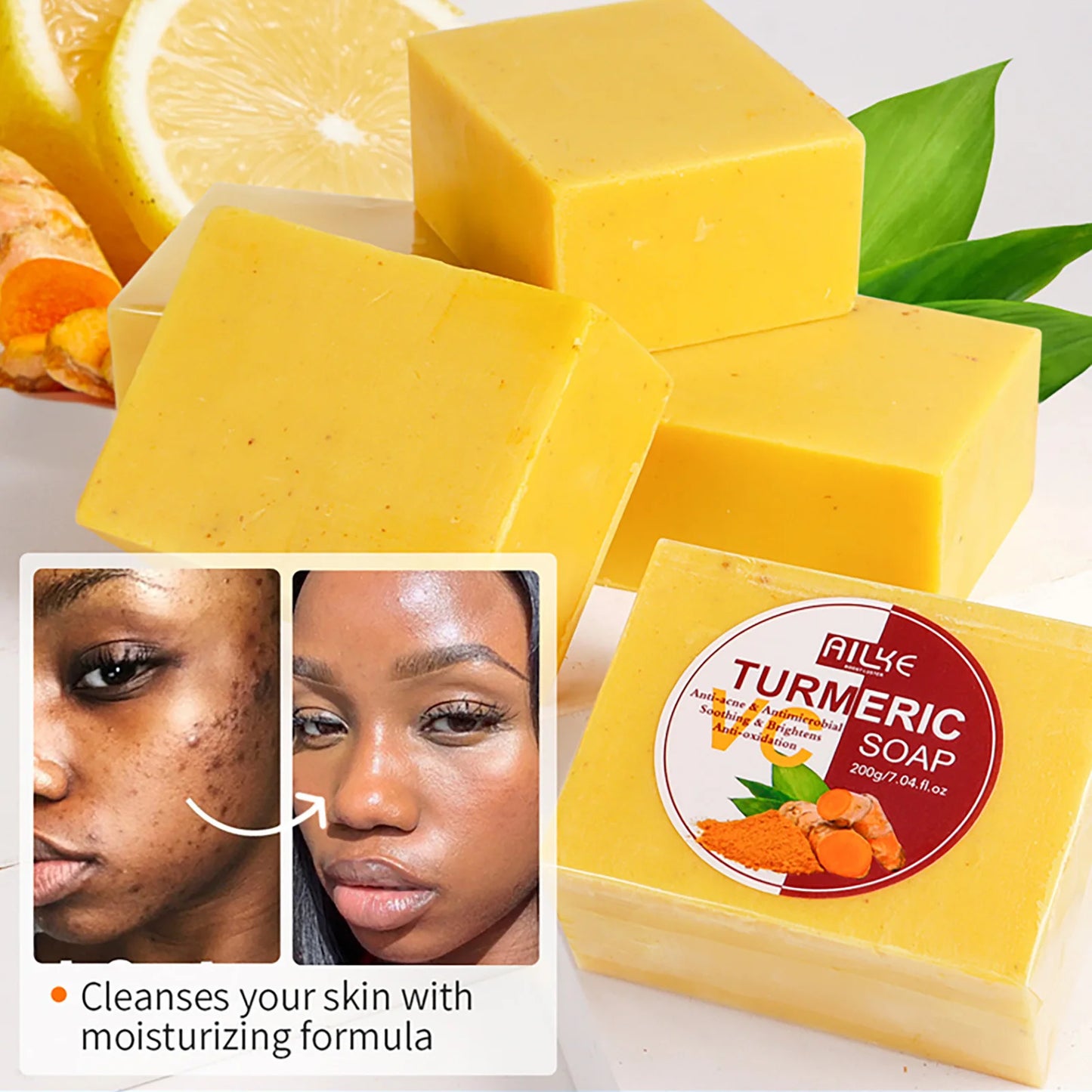 AILKE Natural Turmeric Soap for Face & Body, Whitening