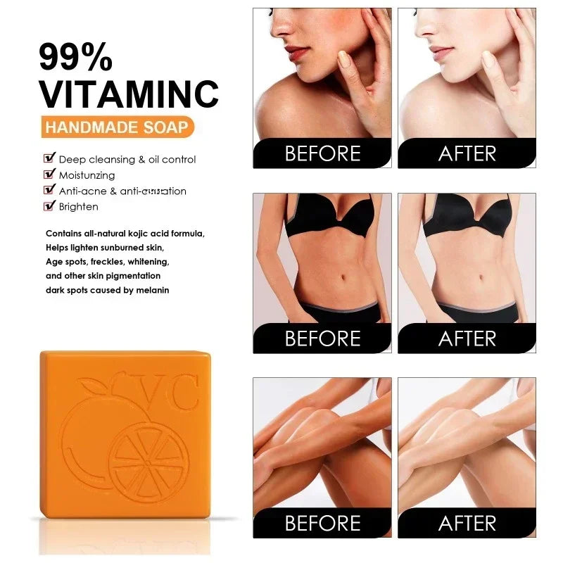 Vitamin C Orange Essence Skin Whitening Soap100g